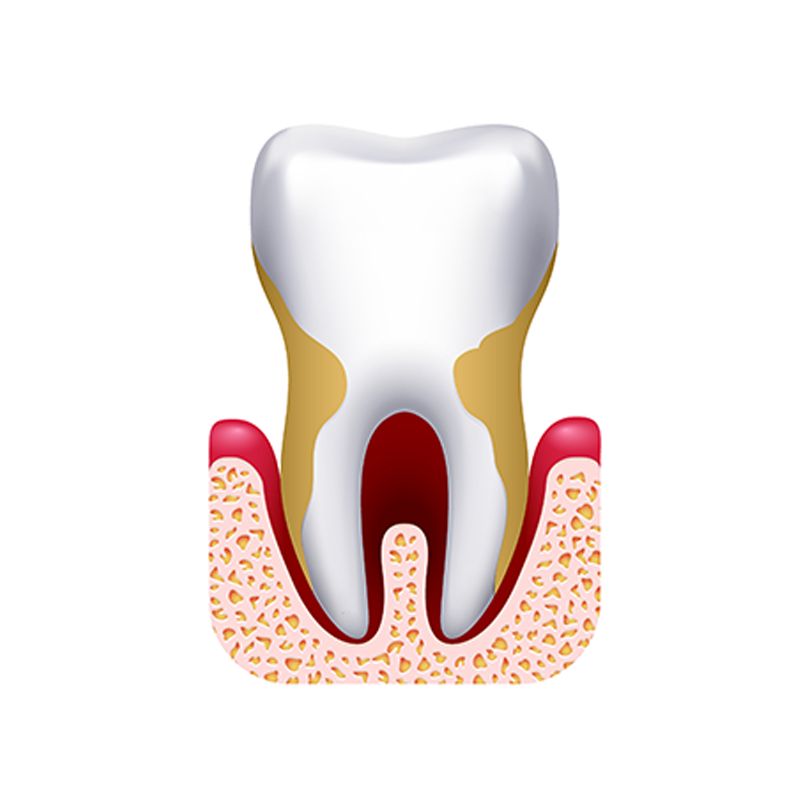 Patient with bleeding gums